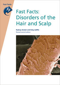 Fast Facts: Disorders of the Hair and Scalp