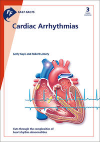 Fast Facts: Cardiac Arrhythmias