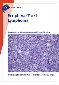 Fast Facts: Peripheral T-cell Lymphoma
