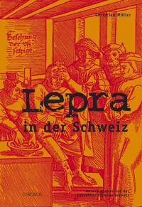 Lepra in der Schweiz