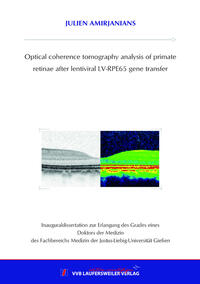 Optical coherence tomography analysis of primate retinae after lentiviral LV-RPE65 gene transfer