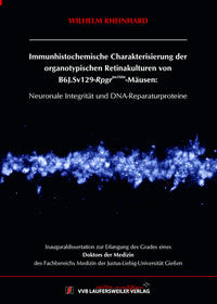 Immunhistochemische Charakterisierung der organotypischen Retinakulturen von B6J.Sv129 Rpgrtm1Stie-Mäusen: