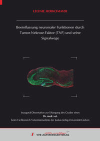 Beeinflussung neuronaler Funktionen durch Tumor-Nekrose-Faktor (TNF) und seine Signalwege