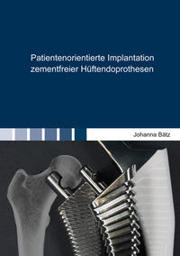 Patientenorientierte Implantation zementfreier Hüftendoprothesen