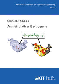 Analysis of Atrial Electrograms