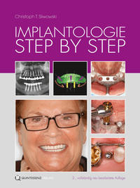Implantologie Step by Step