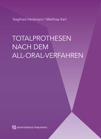 Totalprothesen nach dem All-Oral-Verfahren