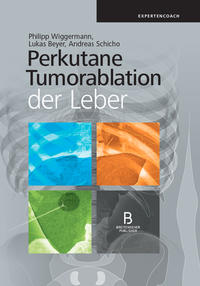 Perkutane Tumorablation der Leber