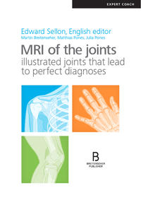 MRI of the joints