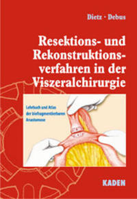 Resektions- und Rekonstruktionsverfahren in der Viszeralchirurgie