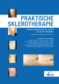 Praktische Sklerotherapie