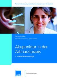 Akupunktur in der Zahnarztpraxis