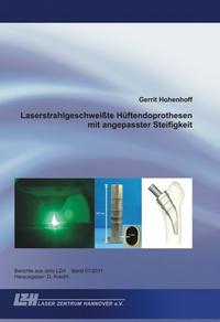 Laserstrahlgeschweißte Hüftendoprothesen mit angepasster Steifigkeit