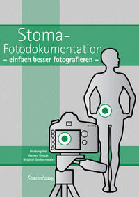 Stoma-Fotodukumentation