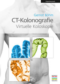 CT-Kolonografie