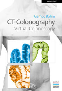 CT Colonography