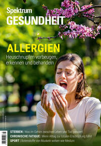 Spektrum Gesundheit - Allergien